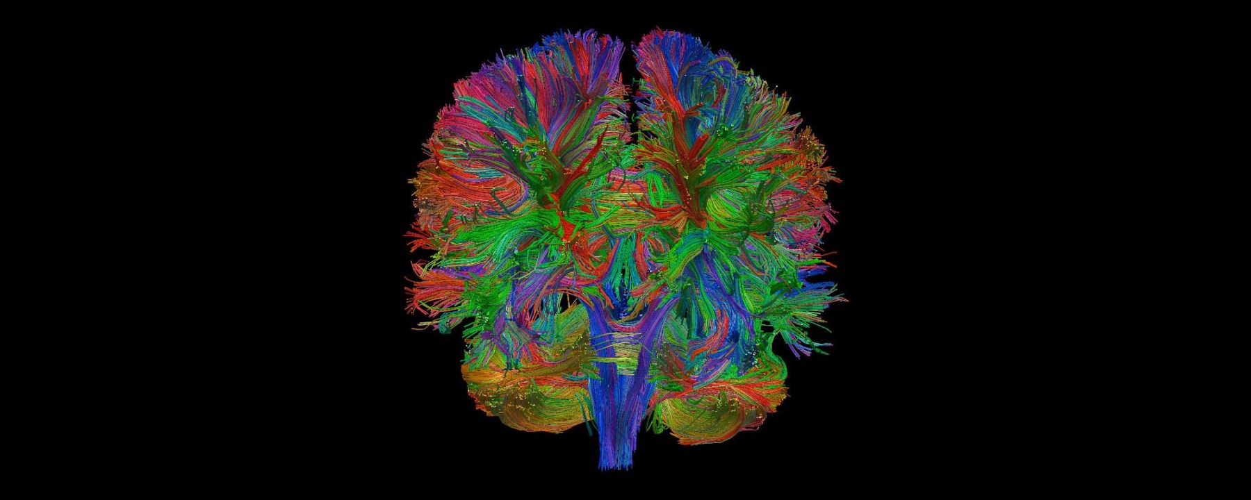 Diffusion Tensor Imaging of whole brain cortico-cortical connectivity in a healthy subject.
