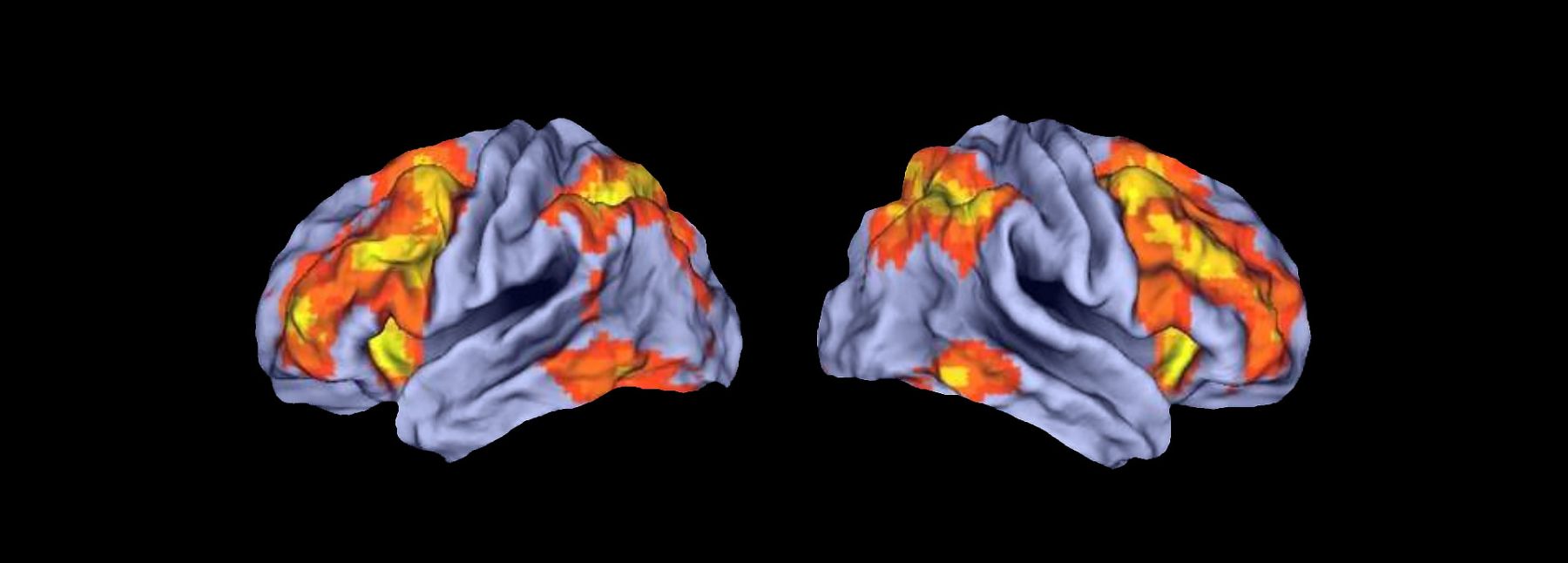 Functional MRI depicts working memory circuitry in the human brain.