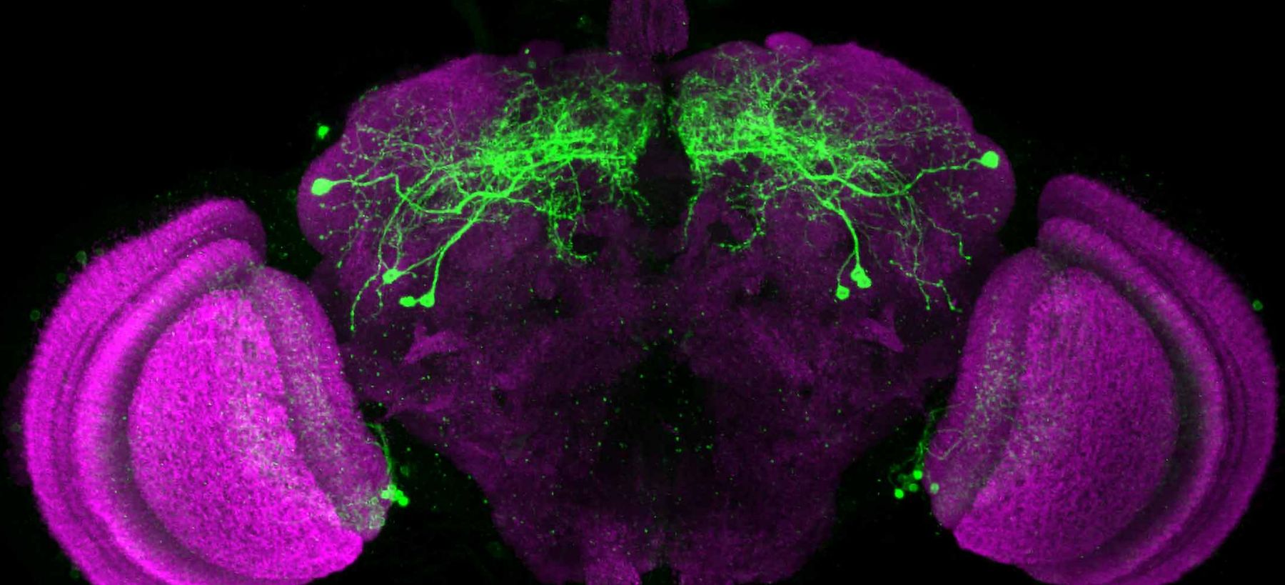 Fly brain stained with a marker to a subset of circadian pacemaker neurons.