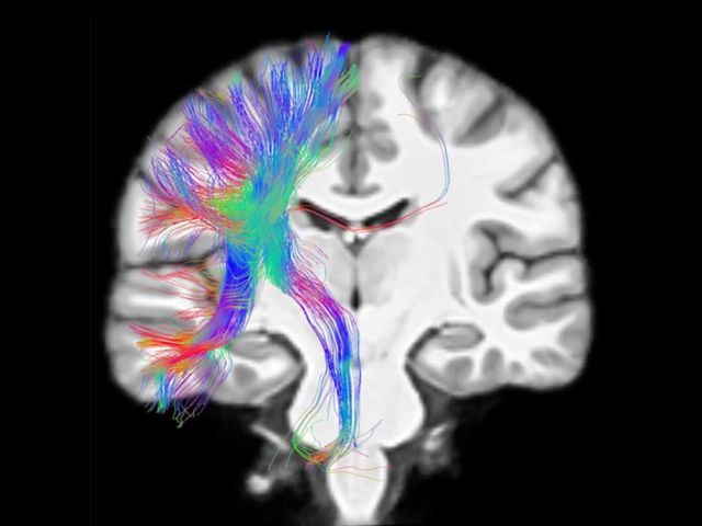 Brain Imaging Center